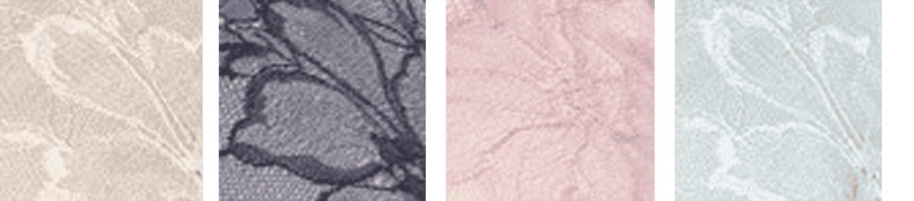 カラーバリエーション